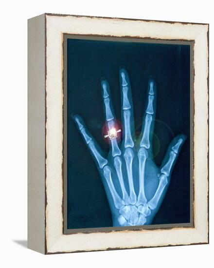 X-ray of hand with diamond ring-Thom Lang-Framed Premier Image Canvas