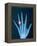 X-ray of hand with diamond ring-Thom Lang-Framed Premier Image Canvas