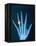 X-ray of hand with diamond ring-Thom Lang-Framed Premier Image Canvas