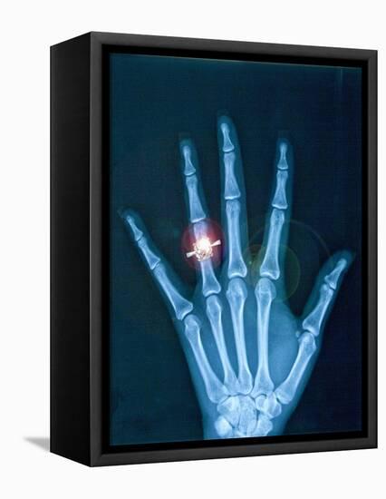 X-ray of hand with diamond ring-Thom Lang-Framed Premier Image Canvas