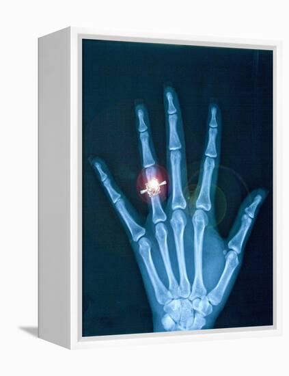 X-ray of hand with diamond ring-Thom Lang-Framed Premier Image Canvas