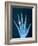 X-ray of hand with diamond ring-Thom Lang-Framed Photographic Print