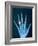 X-ray of hand with diamond ring-Thom Lang-Framed Photographic Print