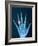 X-ray of hand with diamond ring-Thom Lang-Framed Photographic Print