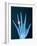 X-ray of hand with diamond ring-Thom Lang-Framed Photographic Print