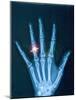 X-ray of hand with diamond ring-Thom Lang-Mounted Photographic Print