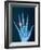 X-ray of hand with diamond ring-Thom Lang-Framed Photographic Print