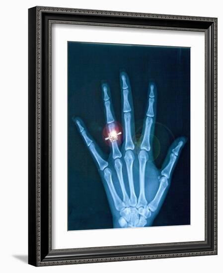 X-ray of hand with diamond ring-Thom Lang-Framed Photographic Print