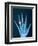 X-ray of hand with diamond ring-Thom Lang-Framed Photographic Print