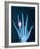 X-ray of hand with diamond ring-Thom Lang-Framed Photographic Print