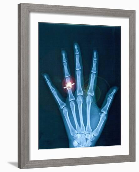 X-ray of hand with diamond ring-Thom Lang-Framed Photographic Print