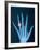 X-ray of hand with diamond ring-Thom Lang-Framed Photographic Print