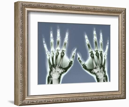 X-ray of Hands-null-Framed Photographic Print