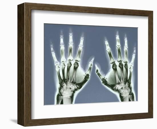 X-ray of Hands-null-Framed Photographic Print