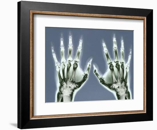 X-ray of Hands-null-Framed Photographic Print