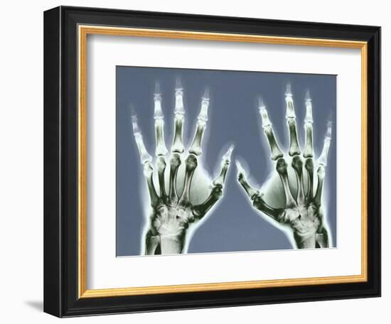 X-ray of Hands-null-Framed Photographic Print