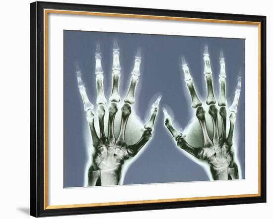 X-ray of Hands-null-Framed Photographic Print