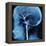 X-Ray of Human Head-Robert Llewellyn-Framed Premier Image Canvas