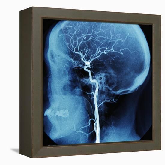 X-Ray of Human Head-Robert Llewellyn-Framed Premier Image Canvas