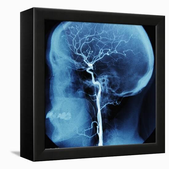 X-Ray of Human Head-Robert Llewellyn-Framed Premier Image Canvas