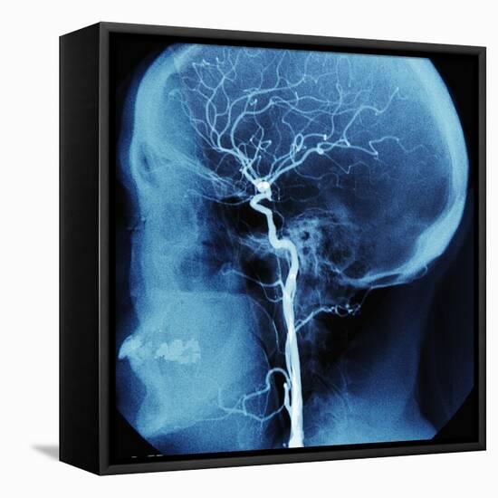 X-Ray of Human Head-Robert Llewellyn-Framed Premier Image Canvas