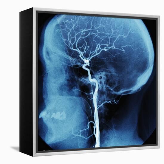 X-Ray of Human Head-Robert Llewellyn-Framed Premier Image Canvas