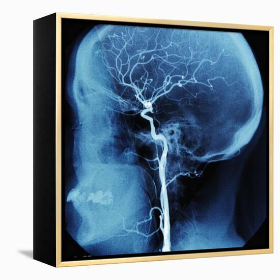 X-Ray of Human Head-Robert Llewellyn-Framed Premier Image Canvas