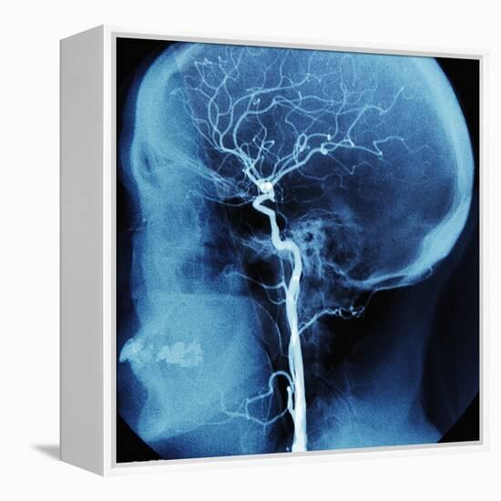 X-Ray of Human Head-Robert Llewellyn-Framed Premier Image Canvas