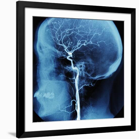 X-Ray of Human Head-Robert Llewellyn-Framed Photographic Print