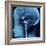 X-Ray of Human Head-Robert Llewellyn-Framed Photographic Print