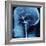 X-Ray of Human Head-Robert Llewellyn-Framed Photographic Print