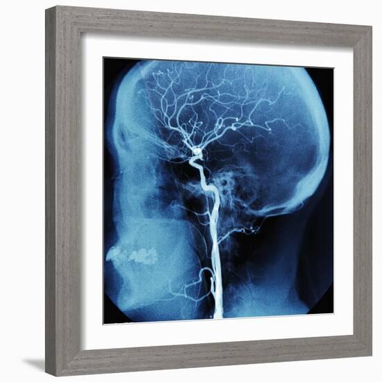 X-Ray of Human Head-Robert Llewellyn-Framed Photographic Print