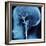 X-Ray of Human Head-Robert Llewellyn-Framed Photographic Print