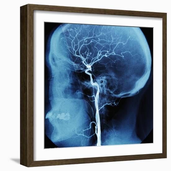 X-Ray of Human Head-Robert Llewellyn-Framed Photographic Print