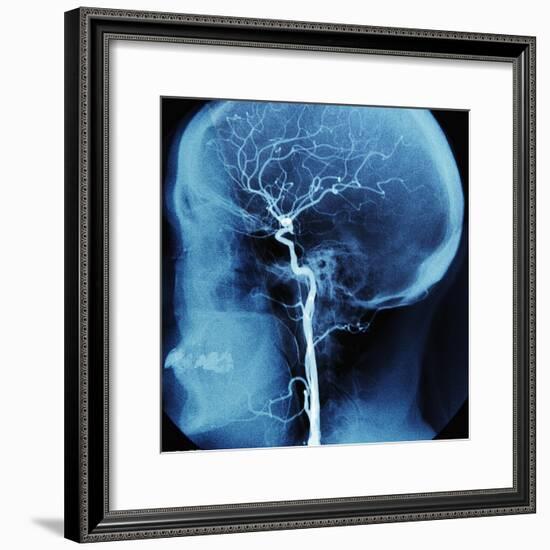 X-Ray of Human Head-Robert Llewellyn-Framed Photographic Print