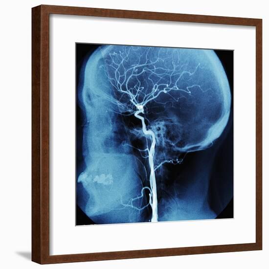 X-Ray of Human Head-Robert Llewellyn-Framed Photographic Print