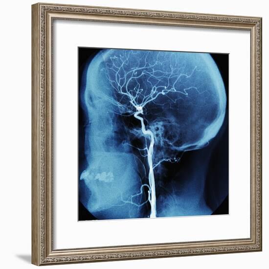 X-Ray of Human Head-Robert Llewellyn-Framed Photographic Print