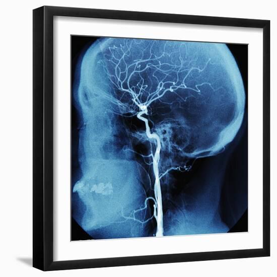 X-Ray of Human Head-Robert Llewellyn-Framed Photographic Print