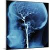 X-Ray of Human Head-Robert Llewellyn-Mounted Photographic Print