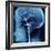 X-Ray of Human Head-Robert Llewellyn-Framed Photographic Print