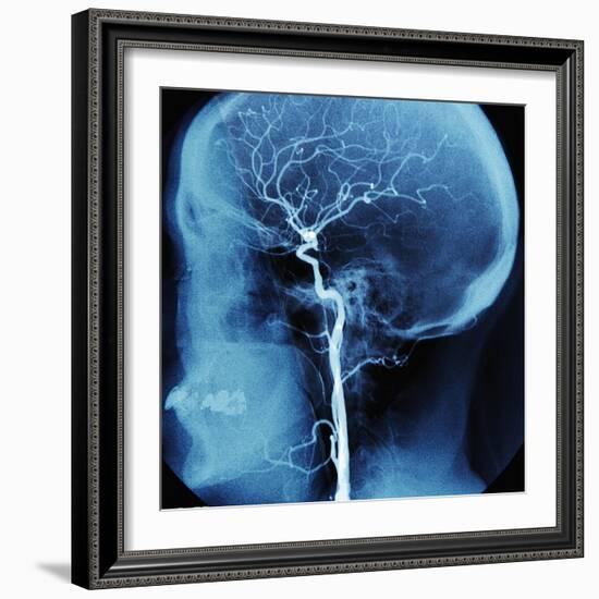 X-Ray of Human Head-Robert Llewellyn-Framed Photographic Print