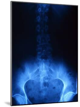 X-Ray of Human Lower Spine-David R. Frazier-Mounted Photographic Print