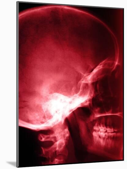 X-Ray of Human Skull-null-Mounted Photographic Print