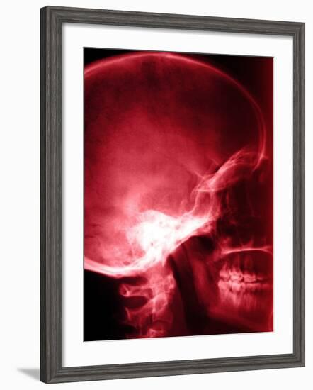 X-Ray of Human Skull-null-Framed Photographic Print