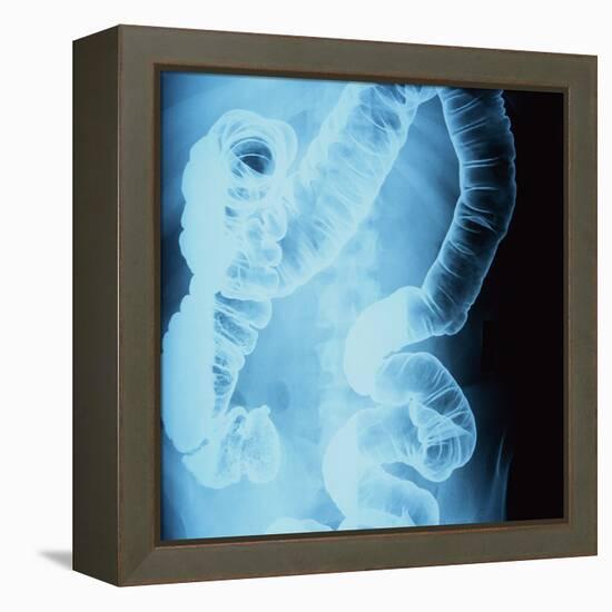 X-Ray of Intestines-Robert Llewellyn-Framed Premier Image Canvas