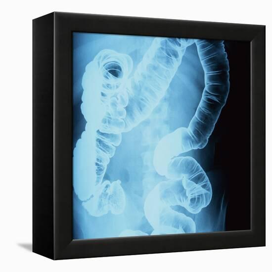 X-Ray of Intestines-Robert Llewellyn-Framed Premier Image Canvas