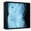 X-Ray of Intestines-Robert Llewellyn-Framed Premier Image Canvas
