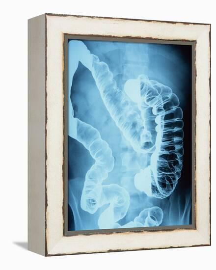 X-Ray of Intestines-Robert Llewellyn-Framed Premier Image Canvas