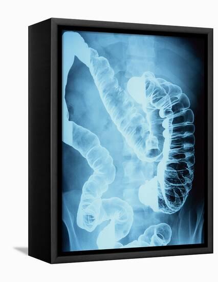 X-Ray of Intestines-Robert Llewellyn-Framed Premier Image Canvas