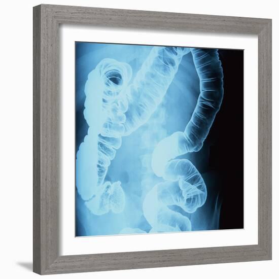 X-Ray of Intestines-Robert Llewellyn-Framed Photographic Print